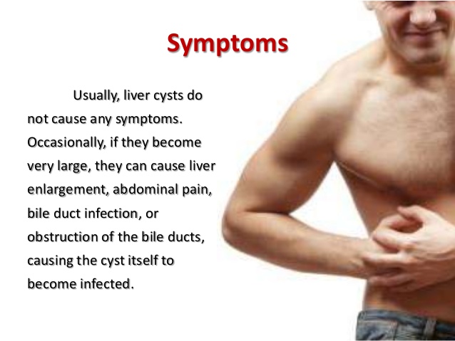 Liver Cyst - its symptoms, prevention and treatment - MyHealth