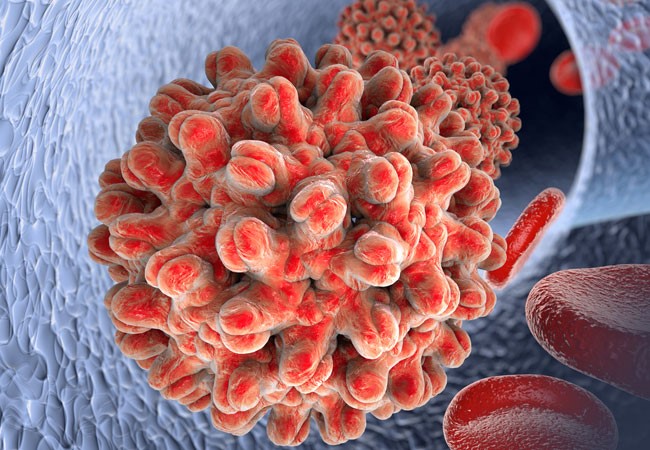 What Is Hepatitis B? 保肝寧B型肝炎中藥馬來西亞1 - What Is Hepatitis B?